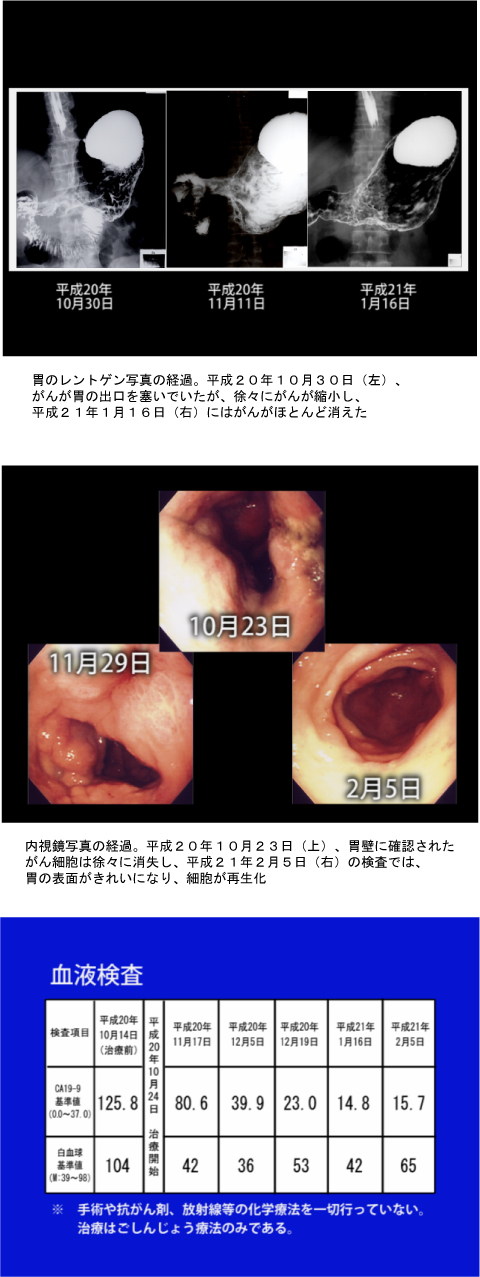 ���E�����