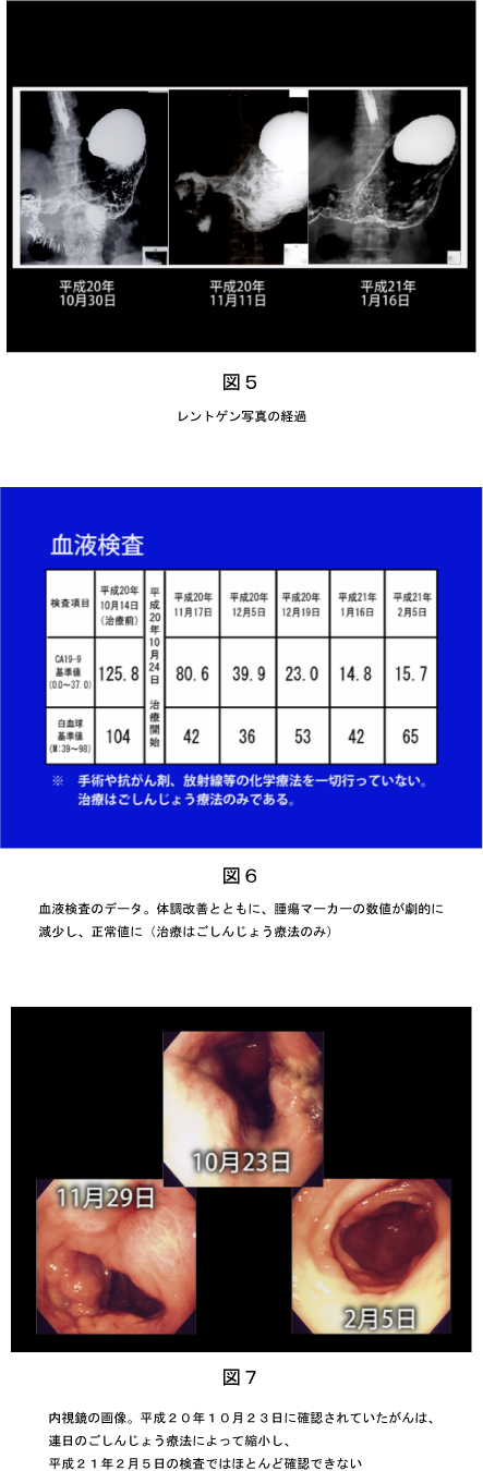 �����񂶂傤�Ö@