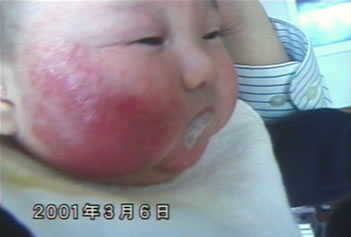 �A�g�s�[���畆���̏Ǘ�