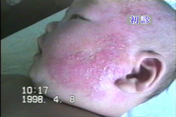 �A�g�s�[���畆���̏Ǘ�